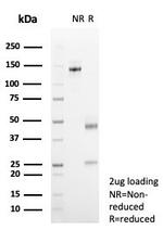 pS2/pNR-2/TFF1 (Estrogen-Regulated Protein) Antibody in SDS-PAGE (SDS-PAGE)