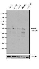 MAVS Recombinant Rabbit Monoclonal Antibody (20H41L5)