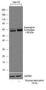 Asparagine Synthetase Antibody in Western Blot (WB)