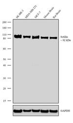 Sortilin Recombinant Rabbit Monoclonal Antibody (10H29L22)