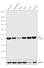 RNF2 Antibody in Western Blot (WB)