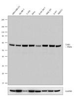 TAB1 Recombinant Rabbit Monoclonal Antibody (21H11L15)