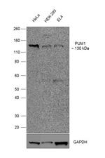 PUM1 Recombinant Rabbit Monoclonal Antibody (8H60L23)