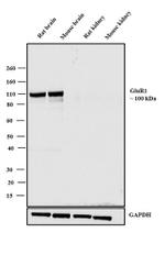 GluR1 Antibody in Western Blot (WB)