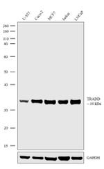 TRADD Recombinant Rabbit Monoclonal Antibody (17H3L22)