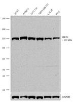 SIRT1 Recombinant Rabbit Monoclonal Antibody (4H9L12)