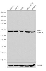 PKM2 Recombinant Rabbit Monoclonal Antibody (3H4L19)