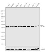 CDK9 Antibody in Western Blot (WB)
