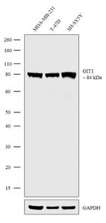 GIT1 Recombinant Rabbit Monoclonal Antibody (3H2L1)
