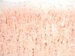 SSTR4 Antibody in Immunohistochemistry (IHC)