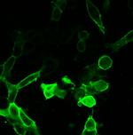 AVPR2 Recombinant Rabbit Monoclonal Antibody (7H28L47)