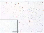 GPR98 Antibody in Immunohistochemistry (IHC)