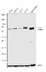 EYA1 Recombinant Rabbit Monoclonal Antibody (24H60L7)