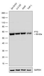 FTO Recombinant Rabbit Monoclonal Antibody (2H63L11)