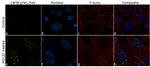 Phospho-beta Catenin (Thr41, Ser45) Recombinant Rabbit Monoclonal Antibody (23H16L13)