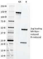 CD71/Transferrin Receptor (TFRC) Antibody in SDS-PAGE (SDS-PAGE)