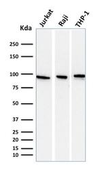 CD71/Transferrin Receptor (TFRC) Antibody in Western Blot (WB)