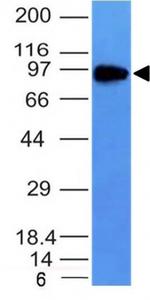 CD71/Transferrin Receptor (TFRC) Antibody in Western Blot (WB)