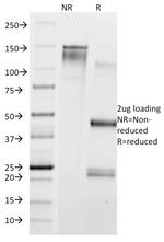 CD71/Transferrin Receptor (TFRC) (Extracellular Domain) Antibody in SDS-PAGE (SDS-PAGE)