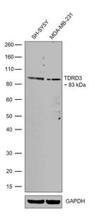 TDRD3 Antibody in Western Blot (WB)