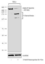 alpha-II Spectrin Recombinant Rabbit Monoclonal Antibody (19H12L58)