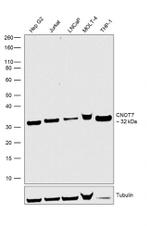 CNOT7 Recombinant Rabbit Monoclonal Antibody (2H45L49)
