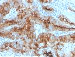 Thyroglobulin (Thyroidal Cell Marker) Monoclonal Antibody (rTGB/4744)