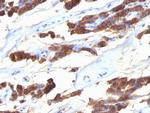 Thyroglobulin (Thyroidal Cell Marker) Monoclonal Antibody (SPM221)