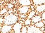 Thyroglobulin (Thyroidal Cell Marker) Antibody in Immunohistochemistry (Paraffin) (IHC (P))
