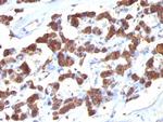 Thyroglobulin (Thyroidal Cell Marker) Monoclonal Antibody (2H11, 6E1)