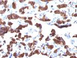 Thyroglobulin (Thyroidal Cell Marker) Monoclonal Antibody (TGB24)