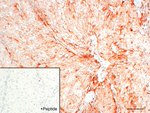 CALCRL Antibody in Immunohistochemistry (IHC)