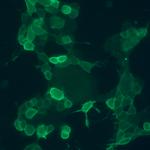 GRPR Recombinant Rabbit Monoclonal Antibody (18H31L38)