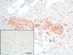 GRPR Antibody in Immunohistochemistry (IHC)