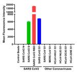 SARS-CoV-2 Spike Protein (RBD) Antibody
