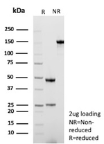 Transforming Growth Factor Beta 1 (TGFB1) (Marker of Tumor Invasiveness) Recombinant Mouse Monoclonal Antibody (rTGFB17)