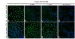 Alexa Fluor 488 Antibody in Immunocytochemistry (ICC/IF)