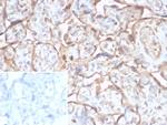 TGFB2 (Transforming Growth Factor beta 2) Monoclonal Antibody (TGFB2/1679)