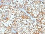 TGFB3/PEIG-1/RAI3/RAIG1/TIG1 Monoclonal Antibody (TGFB3/4801)