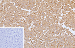 Transforming Growth Factor Beta Receptor 1 (TGFBR1) Antibody in Immunohistochemistry (Paraffin) (IHC (P))