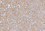 Transforming Growth Factor Beta Receptor 1 (TGFBR1) Recombinant Mouse Monoclonal Antibody (rG3E6)