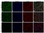 Calreticulin Antibody in Immunocytochemistry (ICC/IF)