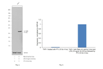 IL-1 beta Antibody in Western Blot (WB)