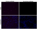 CD25 Antibody in Immunohistochemistry (Paraffin) (IHC (P))