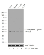 CD254 (RANK Ligand) Recombinant Rabbit Monoclonal Antibody (CD254-Clone 99)