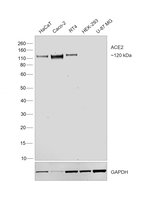 ACE2 Antibody