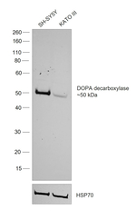 DOPA decarboxylase Antibody in Western Blot (WB)