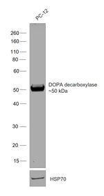 DOPA decarboxylase Antibody in Western Blot (WB)