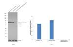 DOPA decarboxylase Antibody in Western Blot (WB)