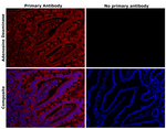 Adenosine Deaminase Recombinant Rabbit Monoclonal Antibody (46H68L66)